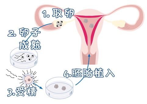 有偿同志供卵代孕怎么预约